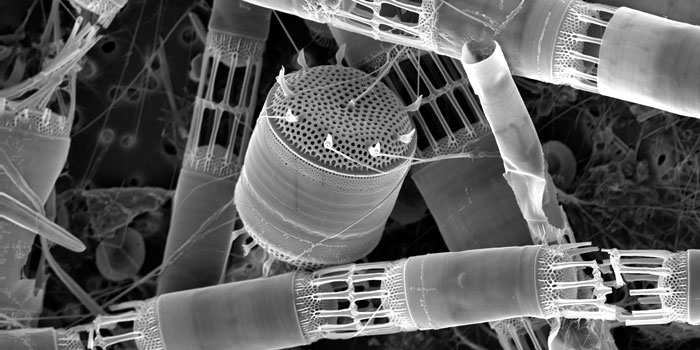 Diatoms (Thalassiosira sp.) Photo: Mikael Heldal, University of Bergen