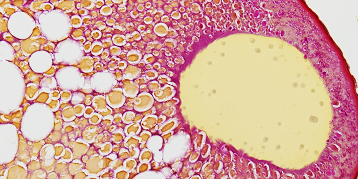 Germinal vesicle in an oocyte of European eel. Photo: Michelle Jørgensen.